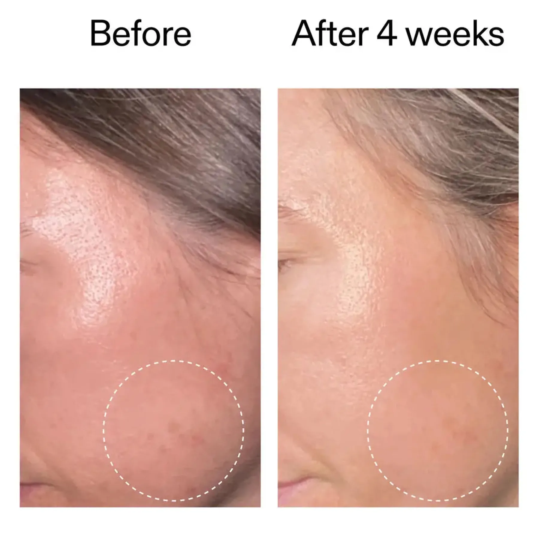 Advanced Retinoid Serum Vegan Pflege|Problemlösende Seren