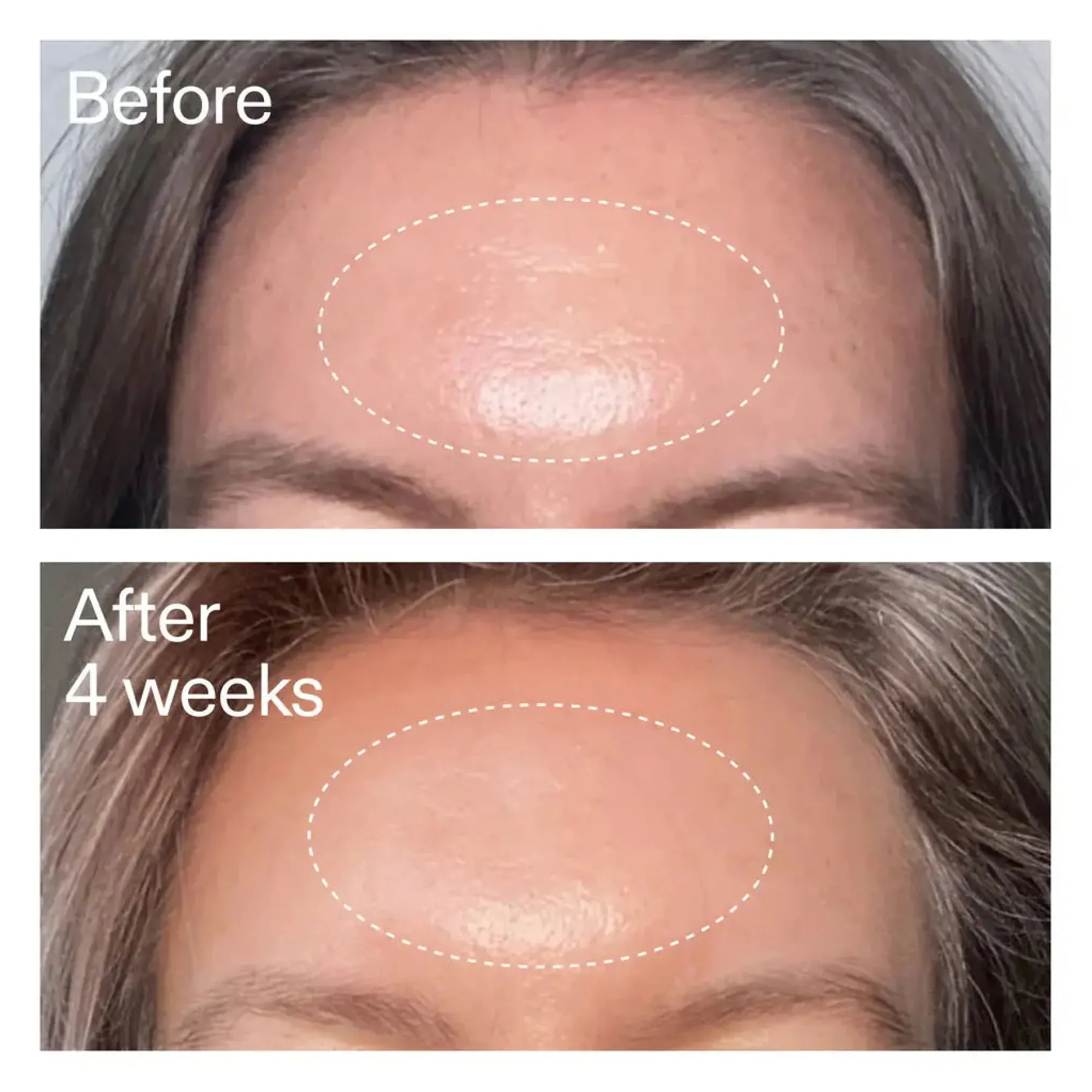 Advanced Retinoid Serum Vegan Pflege|Problemlösende Seren