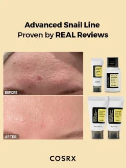 Outlet All About Advanced Snail Kit Hauptzutat|Korean Skincare Routine