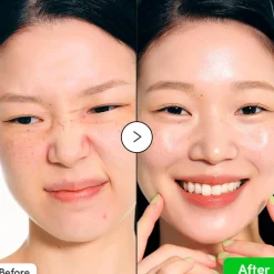 Sale Aloe PDRN Calming Serum Alle Korean Skincare|Problemlösende Seren