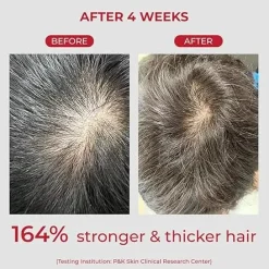 Discount Annurcatin Shampoo Korean Haarpflege|Hauptzutat
