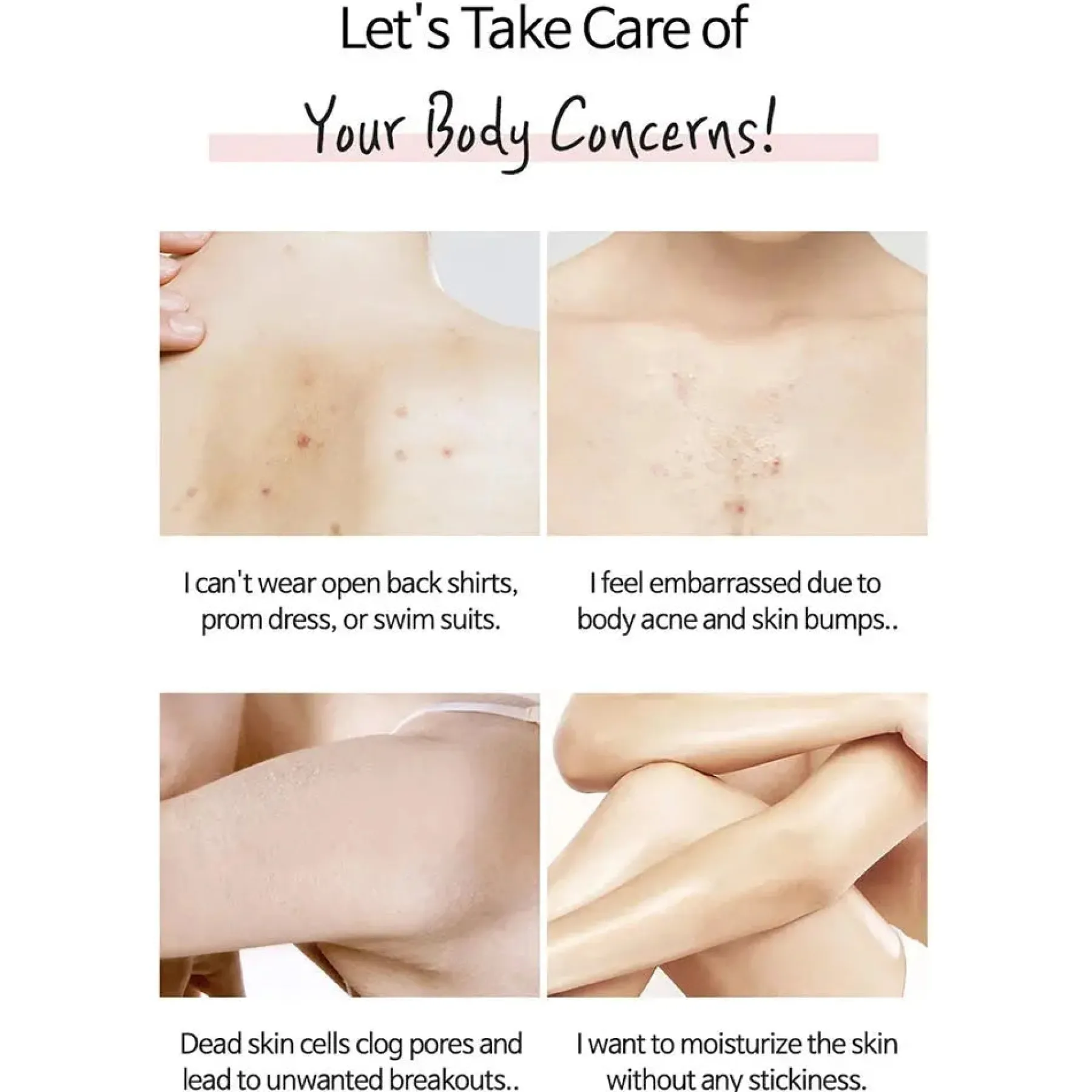 New Anti-blemish Body Lotion Hauptzutat|Körperlotion