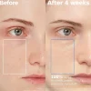 Sale Atobarrier 365 Hydro Cera-HA Serum Alle Korean Skincare|Problemlösende Seren