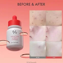 Hot Azelaic 10 & Madeca Ampoule Hauptzutat|Ampoules