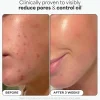 Online BHA Liquid Exfoliant 30 ml. Vegan Pflege|Gesichtsmasken