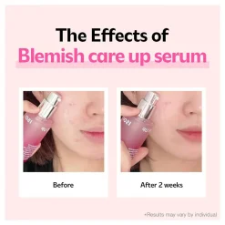 Outlet Blemish Care Up Serum Hauptzutat|Anti-Unreinheiten-Serum