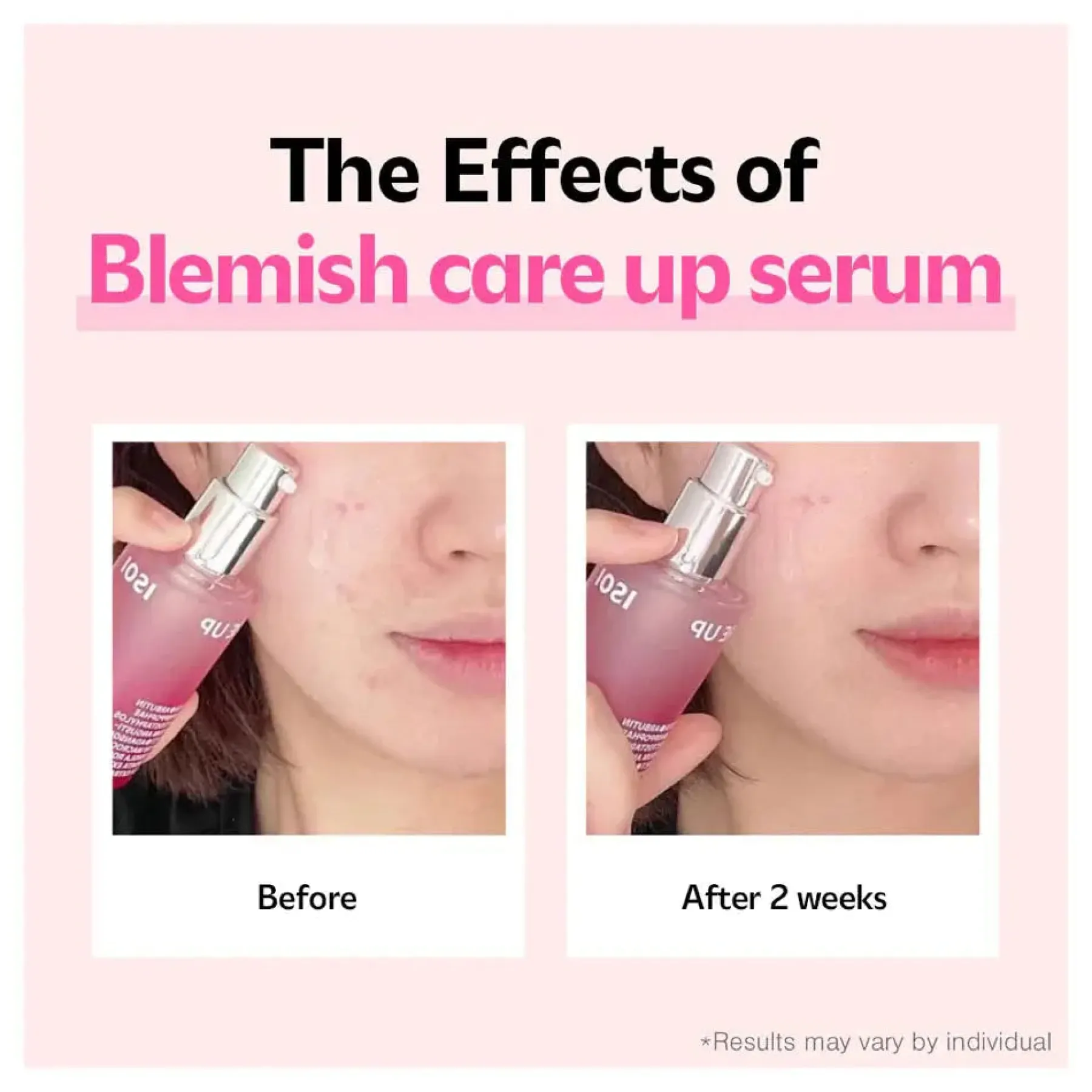 Outlet Blemish Care Up Serum Hauptzutat|Anti-Unreinheiten-Serum