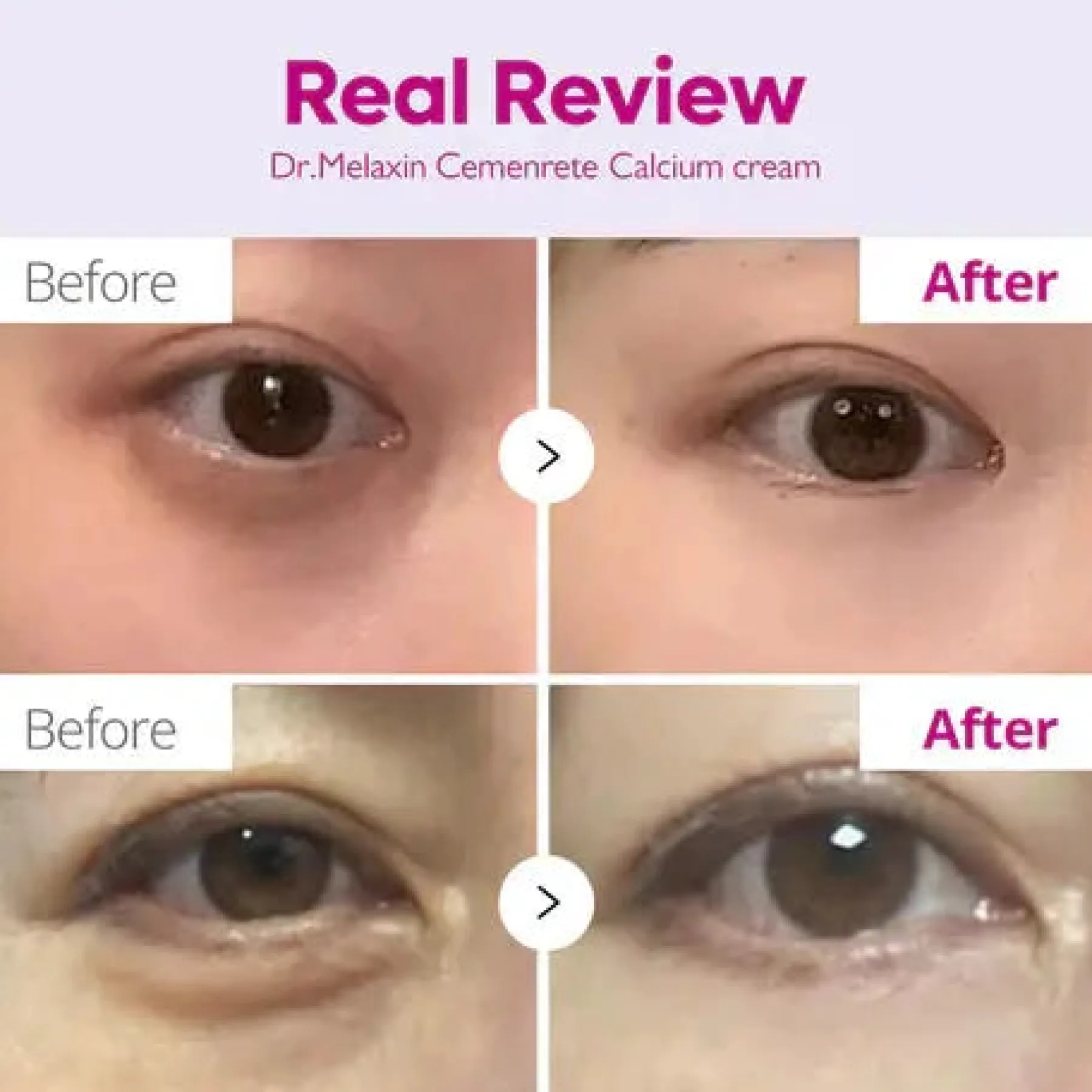 Cemenrete Calcium Intense Cream Alle Korean Skincare|Feuchtigkeitscremes