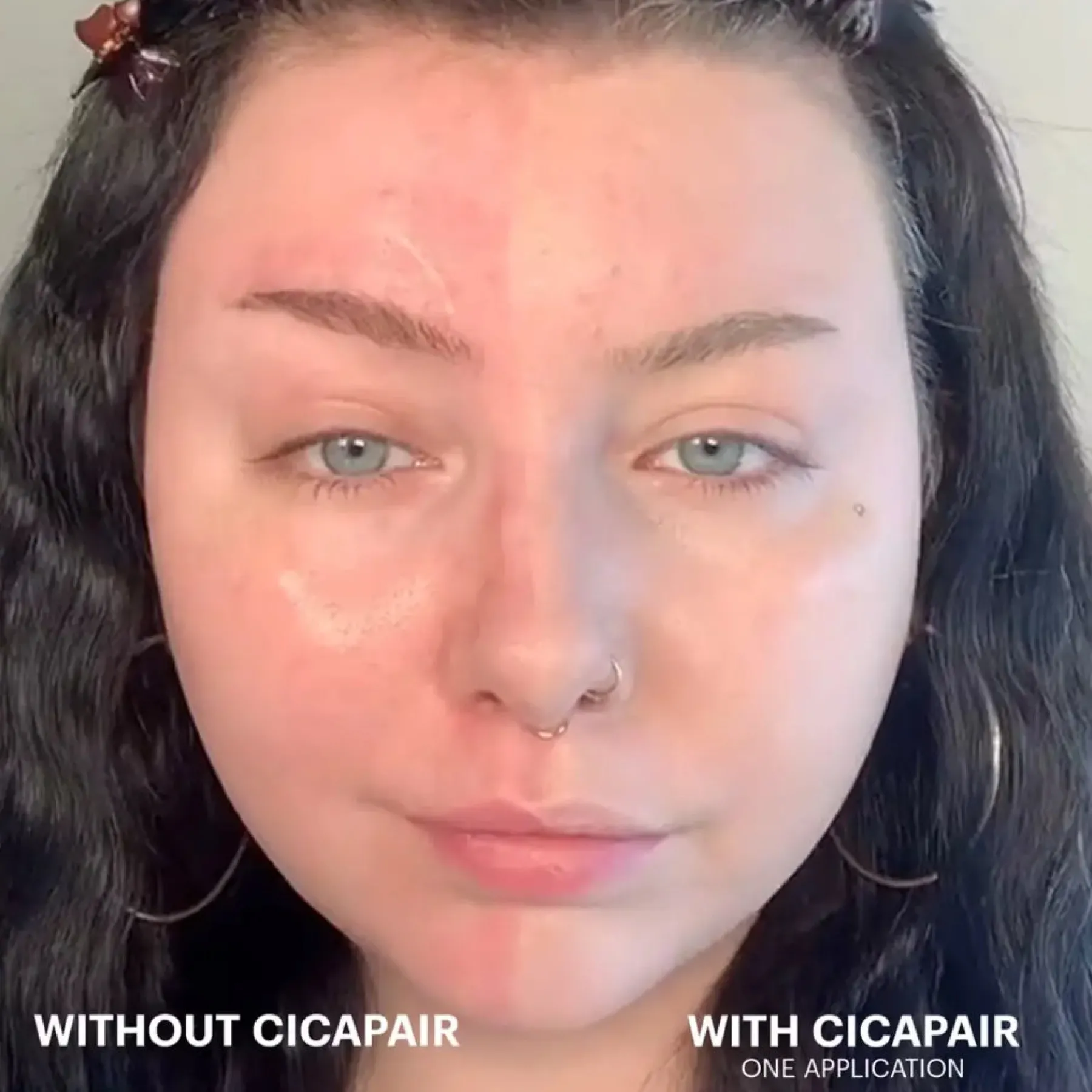 Hot Cicapair Tiger Grass Color Correcting Treatment SPF22 Feuchtigkeitscremes|Hauptzutat