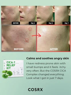 Outlet CICA-7 Relief Kit Hauptzutat|Korean Skincare Routine
