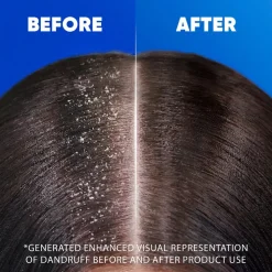 Best Citrus Shampoo Scalp Care|Shampoo