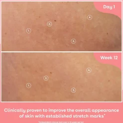 Sale Collagen Body Oil Hauptzutat|Everything Shower