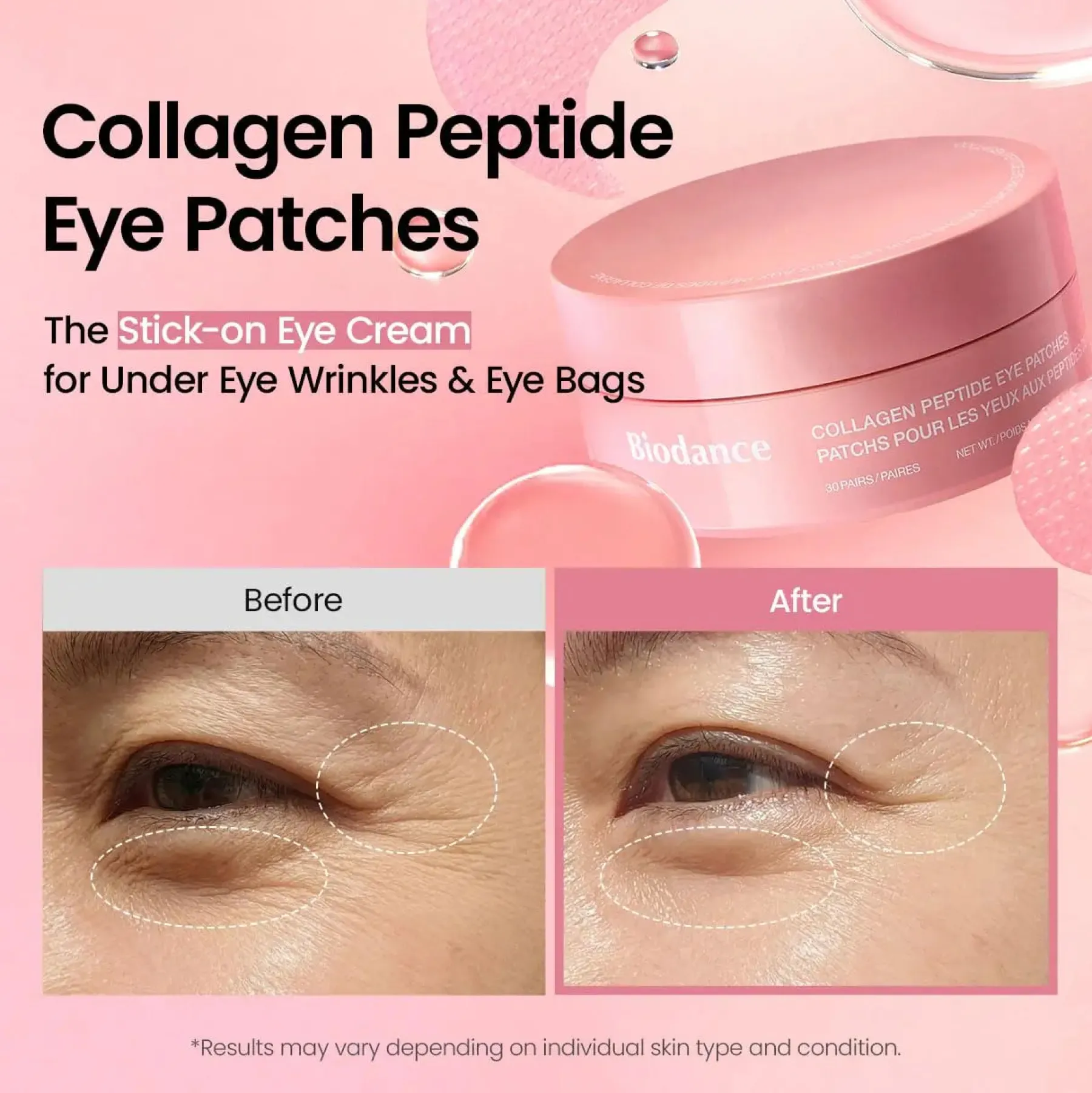Online Collagen Peptide Eye Patches Hauptzutat|Gesichtsmasken