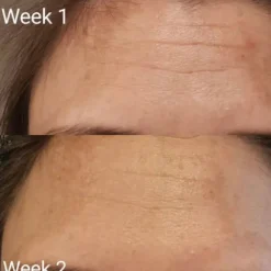 Hot Collagen Tripeptide & Vitamine C Kollagen|Hauptzutat