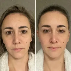 Hot Collagen Tripeptide & Vitamine C Kollagen|Hauptzutat