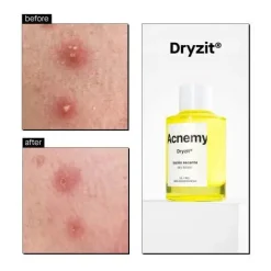 Hot Dryzit Dry Lotion Vegan Pflege