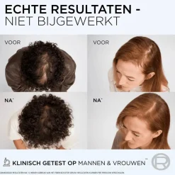 Discount Fiber Booster Shampoo Hair Growth|Haarprobleem