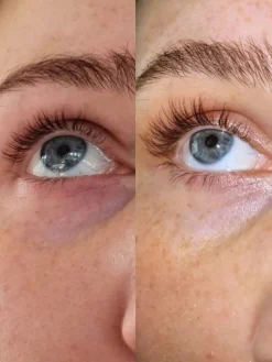 Online Eyelash Growth Serum Wimpernserum
