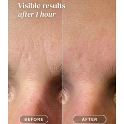 Outlet Facial Patches Niacinamide Vegan Pflege|Gesichtsmasken