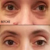 Discount Fermentation Peptine Eye Care Cream Alle Korean Skincare|Hauptzutat