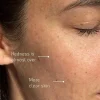 Best Gentle Repair Cream Feuchtigkeitscremes|Hauptzutat
