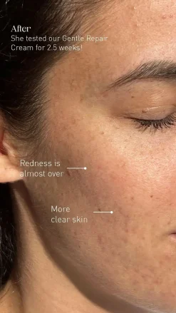 Best Gentle Repair Cream Feuchtigkeitscremes|Hauptzutat