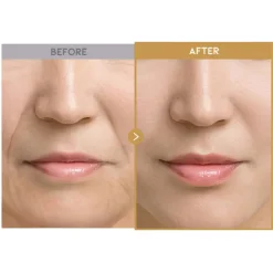 Best Glass Skin Rice Water Toner Pad Alle Korean Skincare|Toners