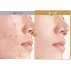 Best Glass Skin Rice Water Toner Pad Alle Korean Skincare|Toners