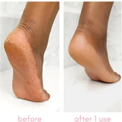 Best Heel-ing Callus Remover Vegan Pflege|Fußpflege