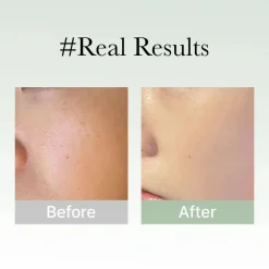 New Holy Hyssop Serum 30 Alle Korean Skincare|Problemlösende Seren