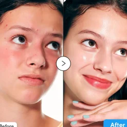 Online Hyaltoin Flooding Serum Vegan Pflege|Problemlösende Seren