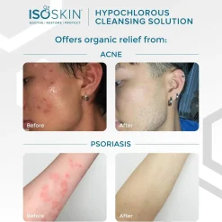 Online Hypochlorous Spray Vegan Pflege|Toners