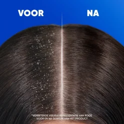 Discount Intense Hydration Shampoo Scalp Care|Shampoo