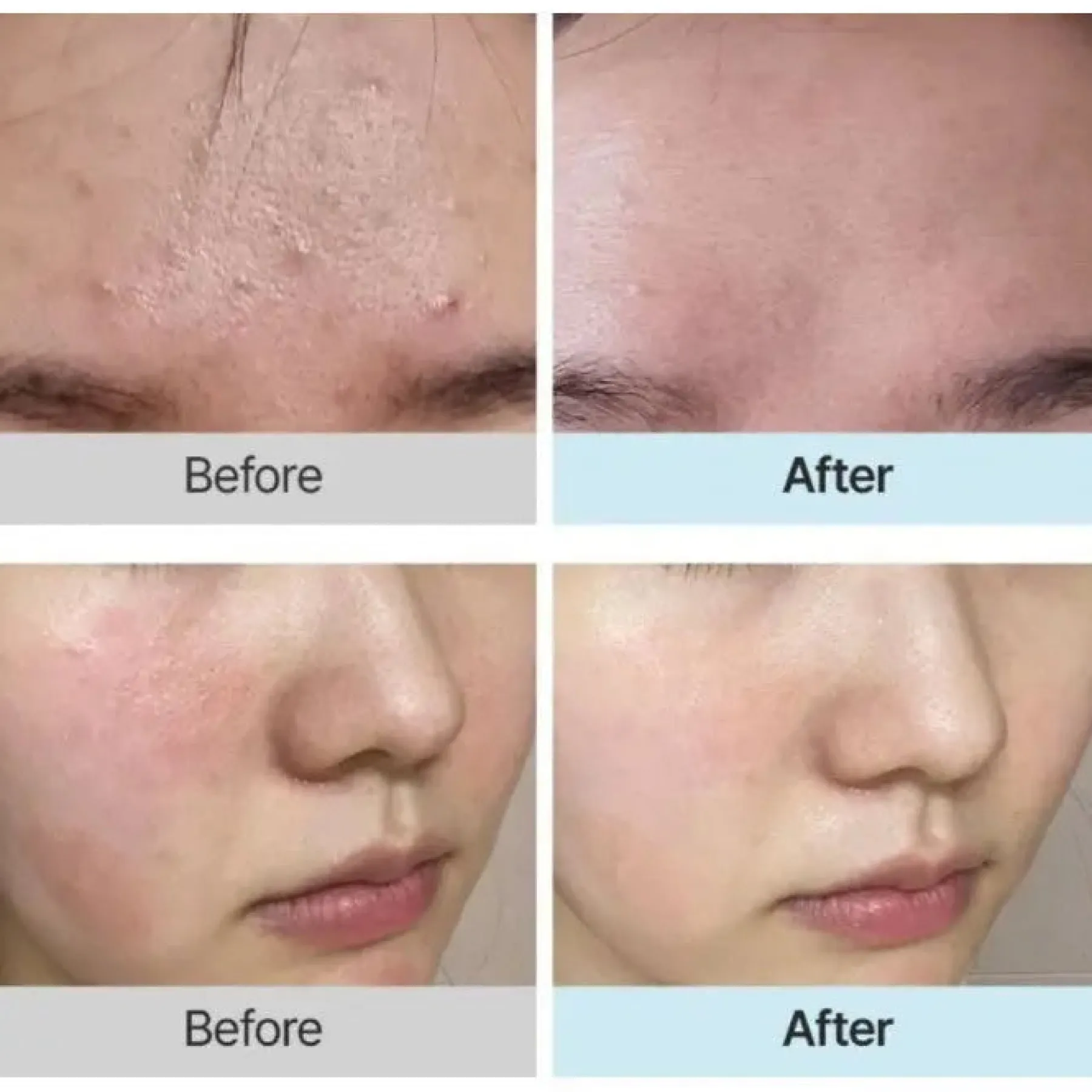 Online Licorice First Essence Alle Korean Skincare|Essence