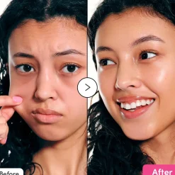New Nad+ Peptide Boosting Serum Hauptzutat|Anti-Unreinheiten-Serum