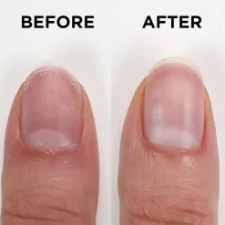 Best Nailtrition Nagelhärter