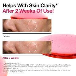 New Niacinamide 10% + TXA 4% Dark Spot Correcting Serum Hauptzutat|Anti-Unreinheiten-Serum