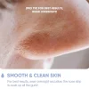 Clearance Nose Patch For Pores Vegan Pflege|Hautprobleme
