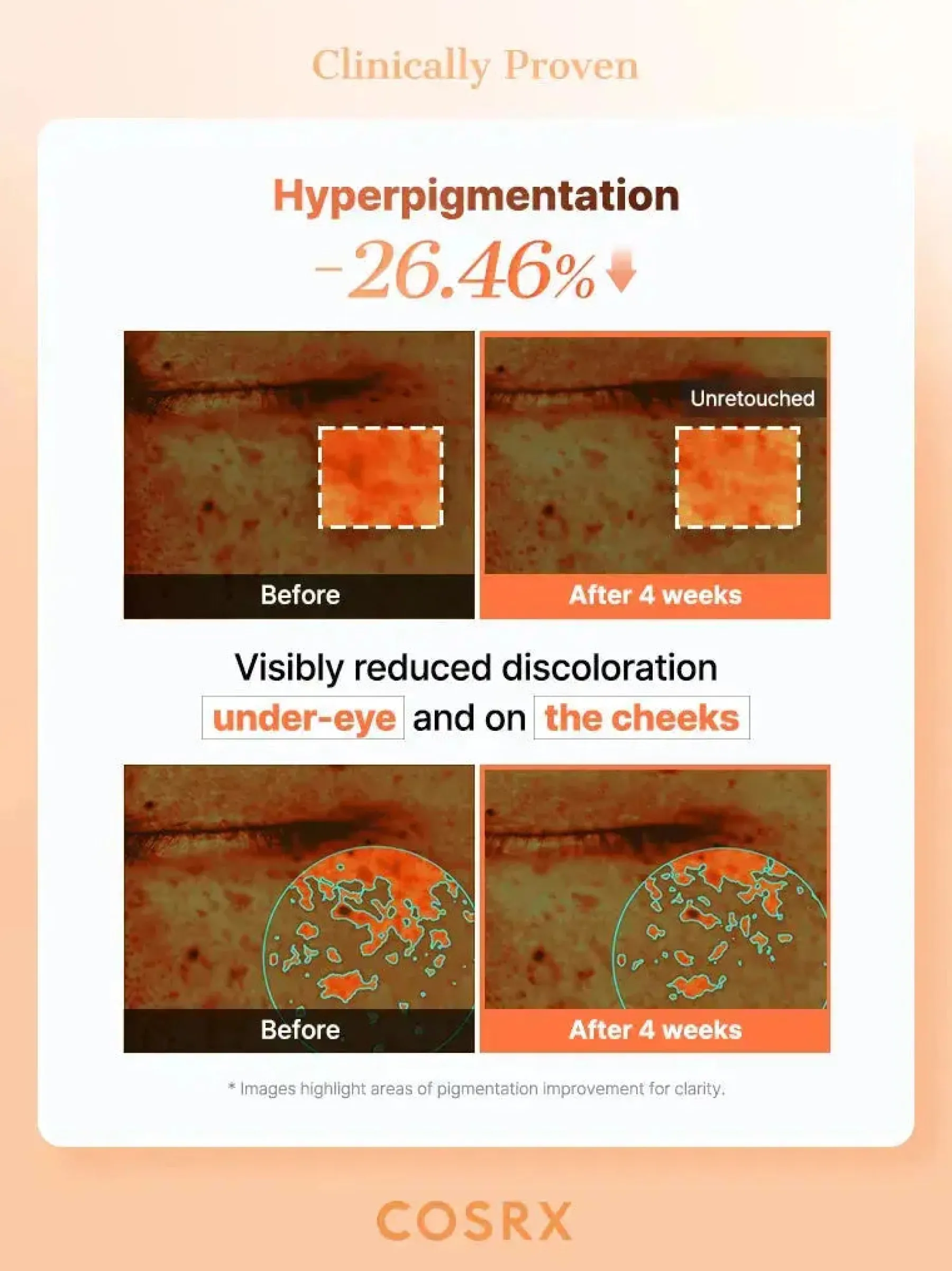 Hot 5 PDRN Collagen Vitalizing Hydrogel Eye Patch Hauptzutat|Gesichtsmasken