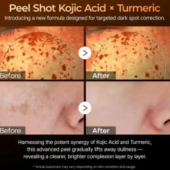 Peel Shot Exfoliating Kojic Acid Turmeric Serum Hauptzutat|Vegan Pflege
