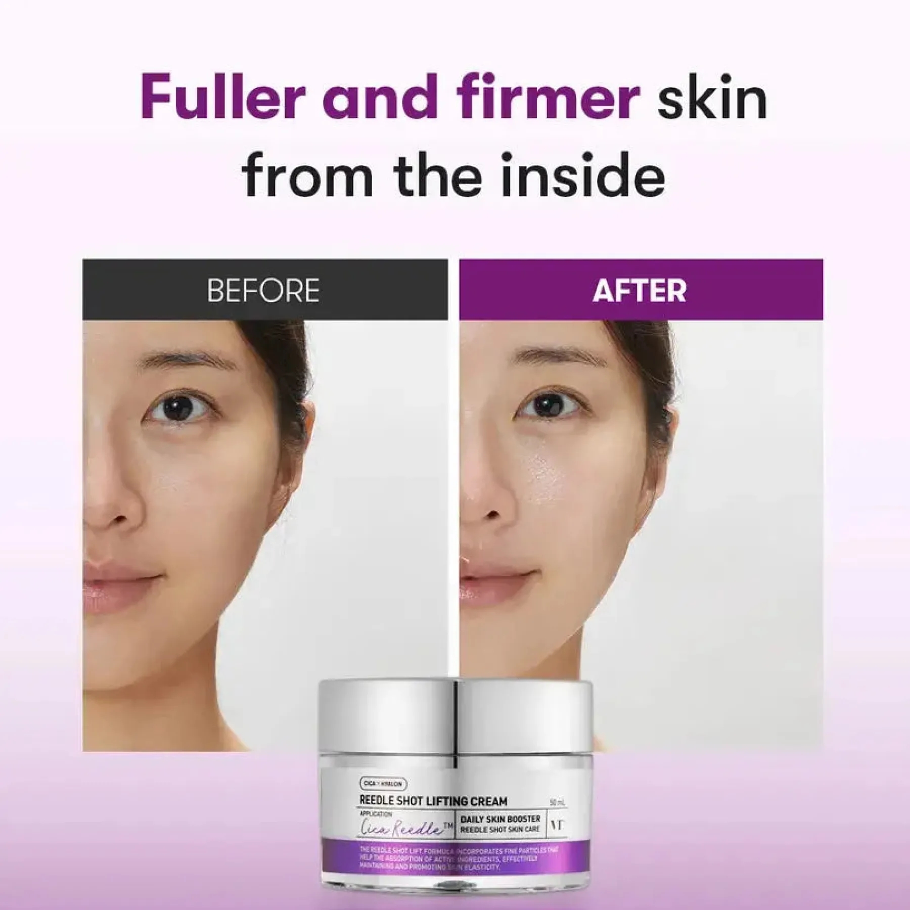 Hot Reedle Shot Lifting Cream Alle Korean Skincare|Feuchtigkeitscremes