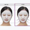 Sale Reedle Shot Lifting Mask Alle Korean Skincare|Gesichtsmasken