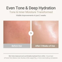 Ricefila Oil Toner Vegan Pflege|Toners