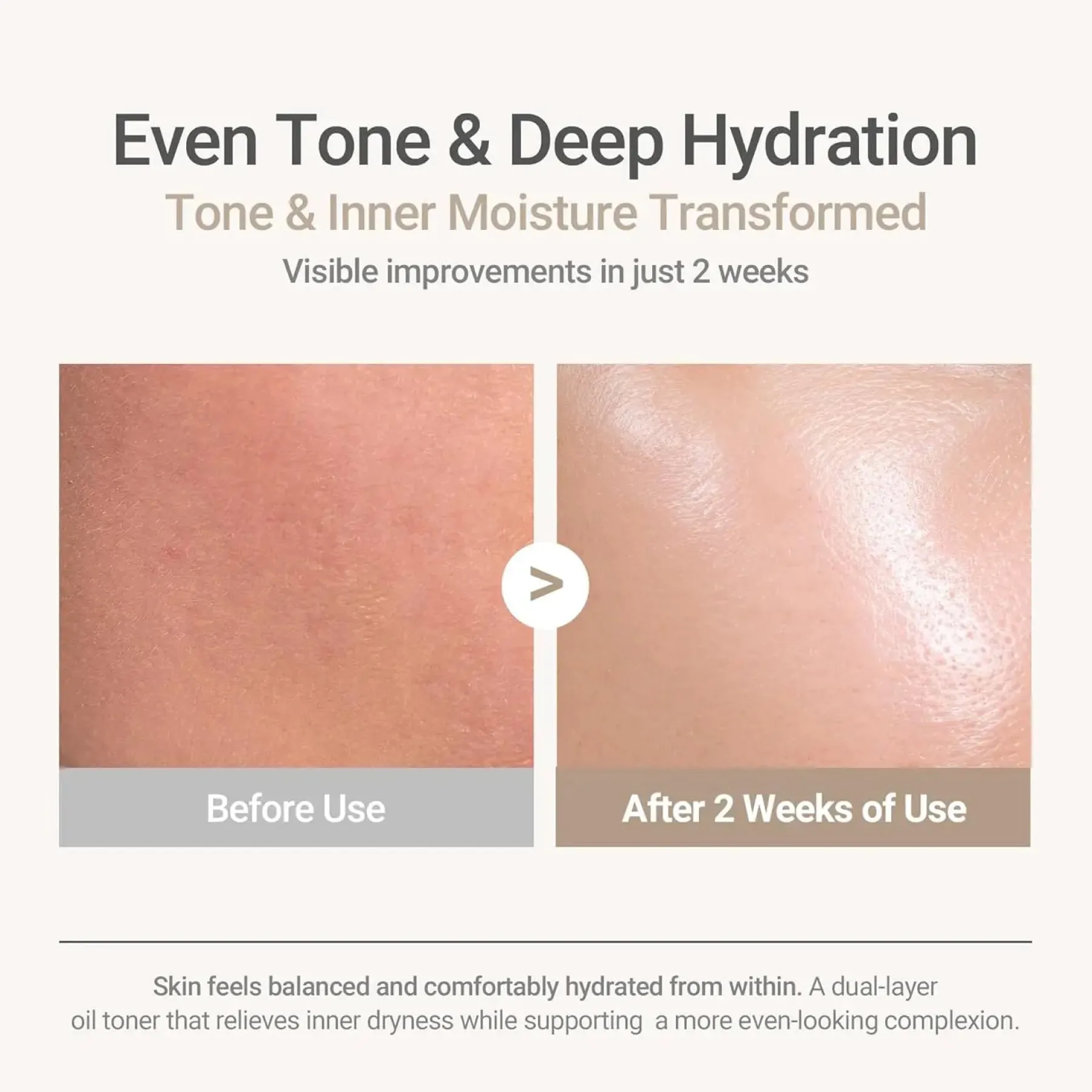 Ricefila Oil Toner Vegan Pflege|Toners