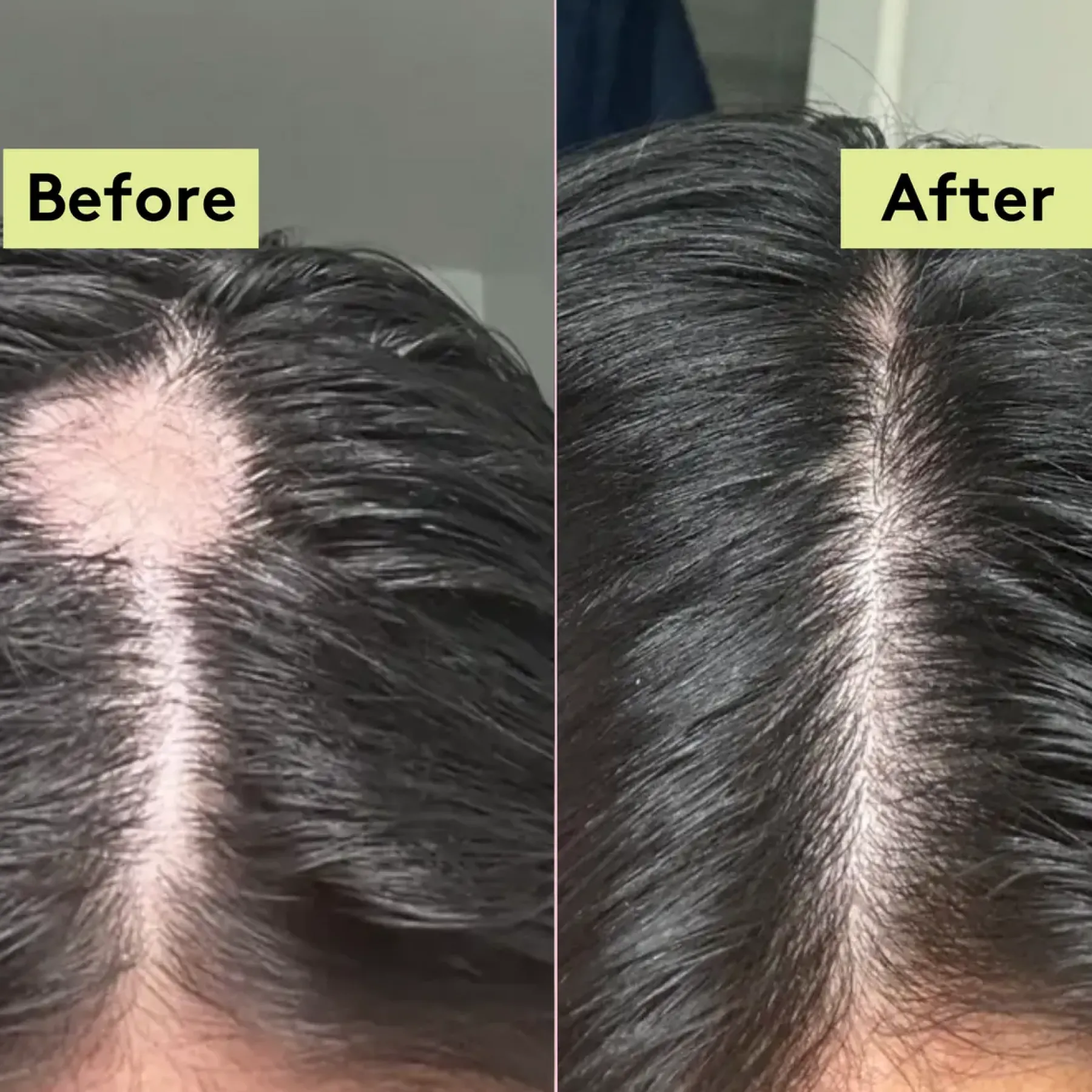 Discount Rich Roots Hair & Scalp Oil Amla & Rosemary Hair Growth|11 Schritte Haarpflege Routine
