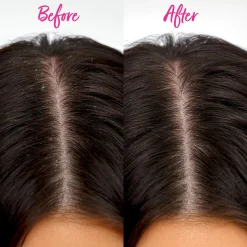 Best Scalp Detox Comb Hair Growth|11 Schritte Haarpflege Routine