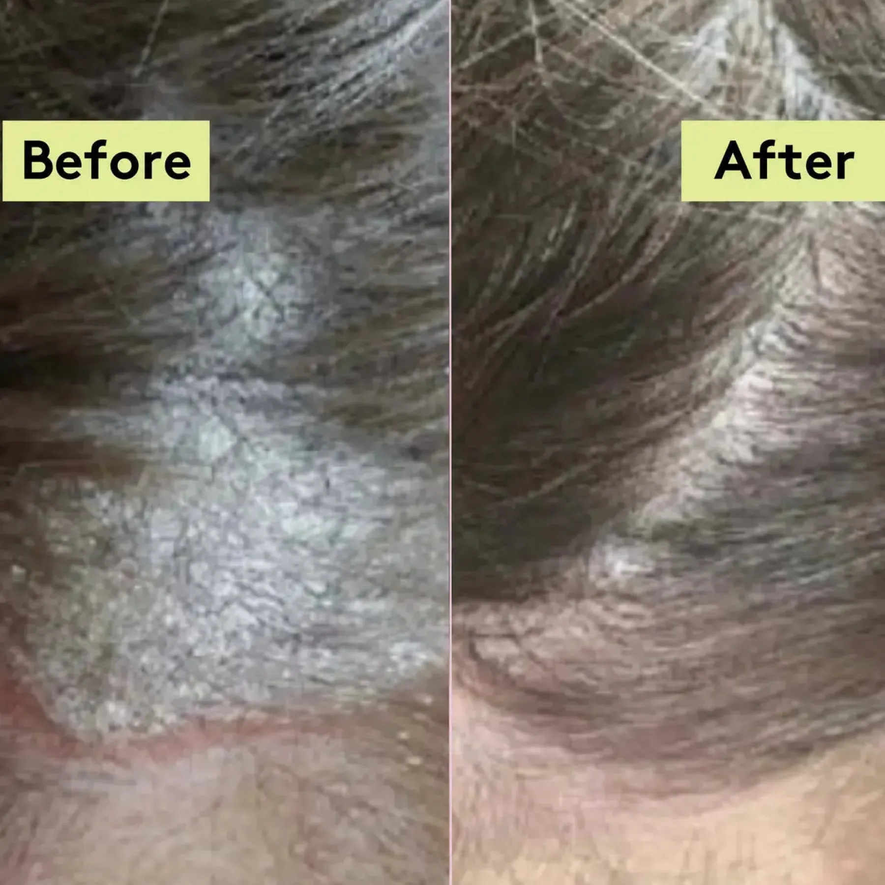 Best Scalp-Eaze Scalp Balm Amla Berry & Mango Butter Hair Growth|11 Schritte Haarpflege Routine