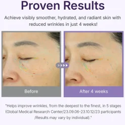 New 360º Shot PDRN Active Serum Hauptzutat|Anti-Unreinheiten-Serum