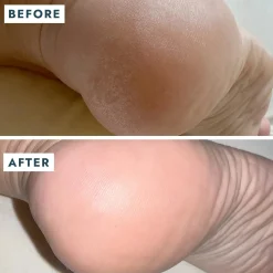 Clearance SoleMate Heel Repair Balm Vegan Pflege|Fußpflege
