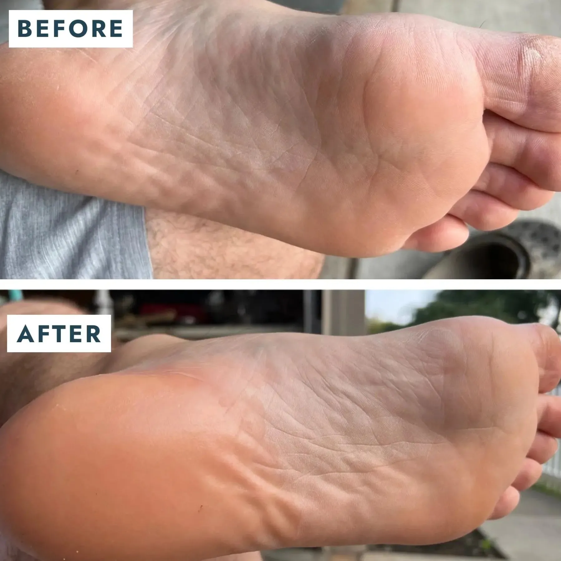 Clearance SoleMate Heel Repair Balm Vegan Pflege|Fußpflege